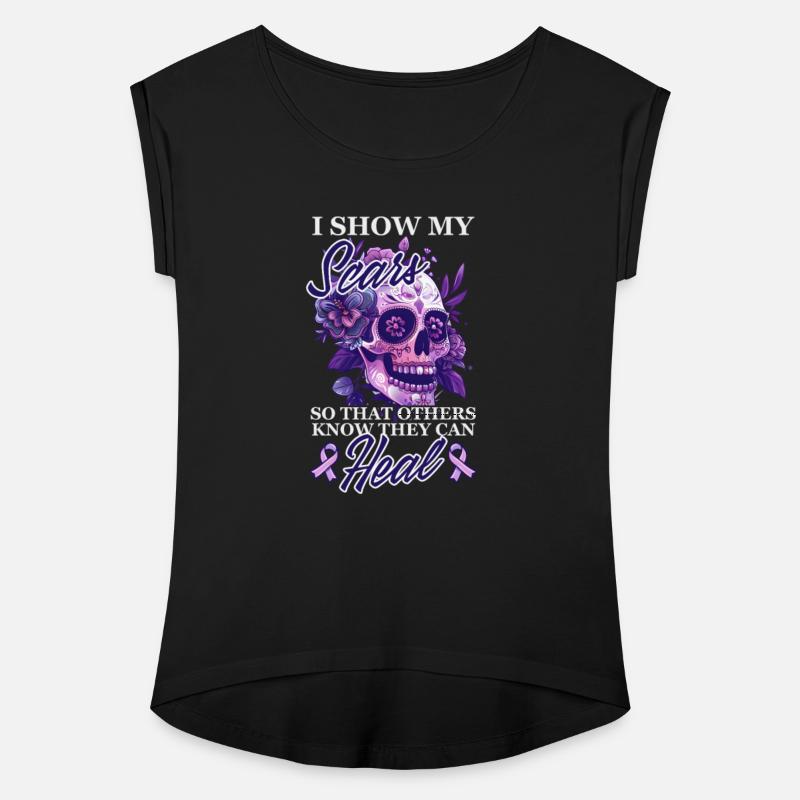 Domestic Violence Show Scars Others Know They Heal